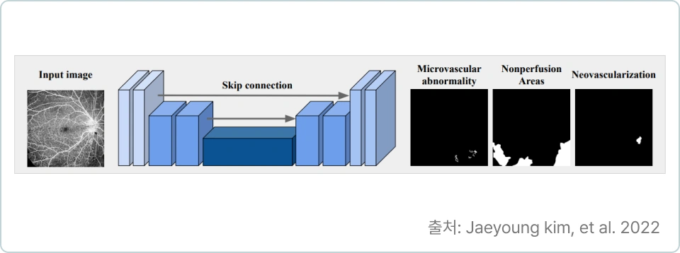 ImageSlide<b>3. Bag of Tricks for Developing Diabetic Retinopathy Analysis 
Framework to Overcome Data Scarcity</b>