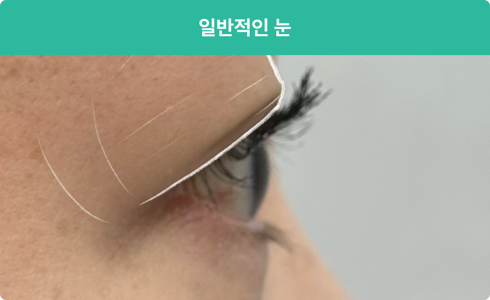 ImageSlide
