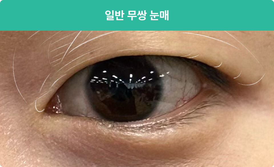 ImageSlide