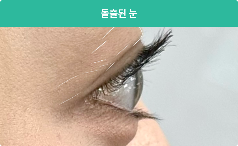 ImageSlide