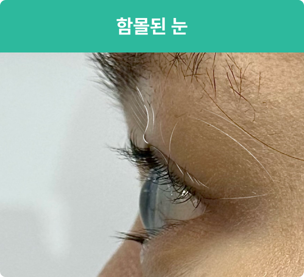 ImageSlide