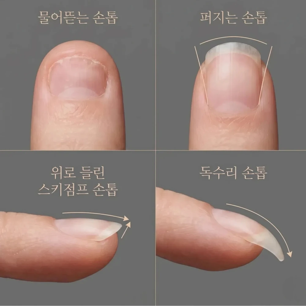 <p>휘어진 손톱부터 스키점프까지, 손톱 유형별 진단법</p>
