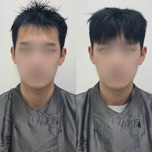 증모술전문가, 은파 강의예제