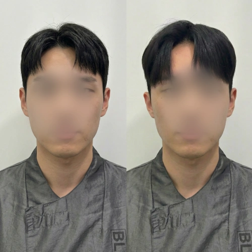 증모술전문가, 은파 강의예제