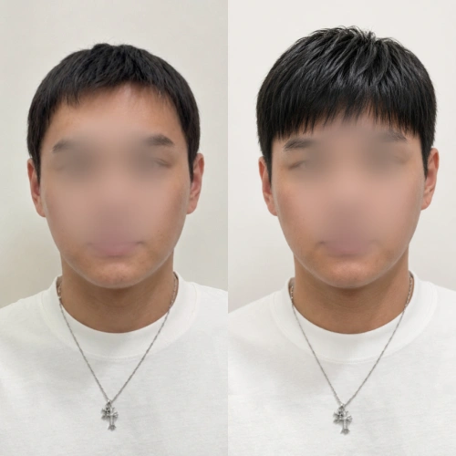 증모술전문가, 은파 강의예제