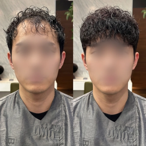 증모술전문가, 은파 강의예제