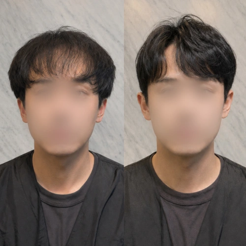 증모술전문가, 은파 강의예제