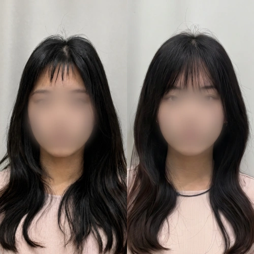 증모술전문가, 은파 강의예제