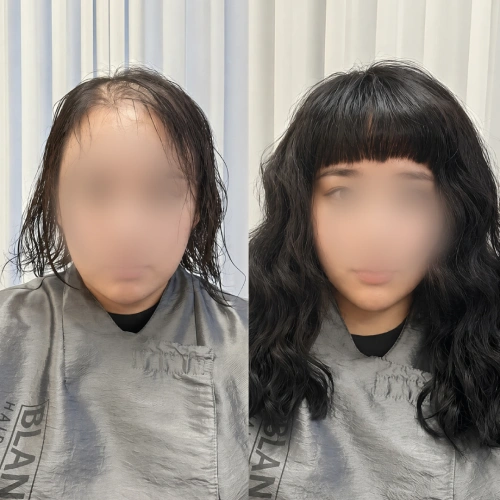 증모술전문가, 은파 강의예제