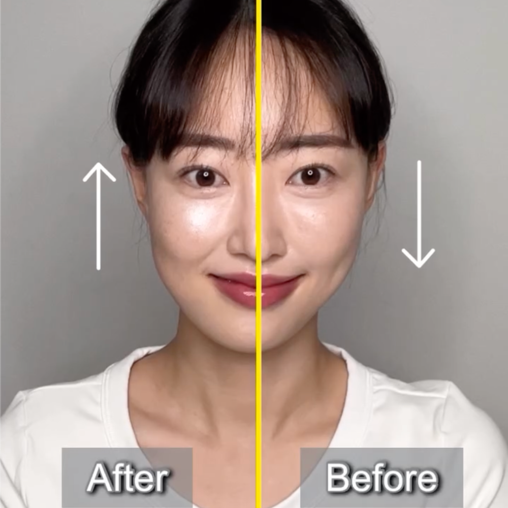 <p><strong>꺼진 볼은 살리고 팔자는 끌어올리는 중안부 리프팅</strong></p>