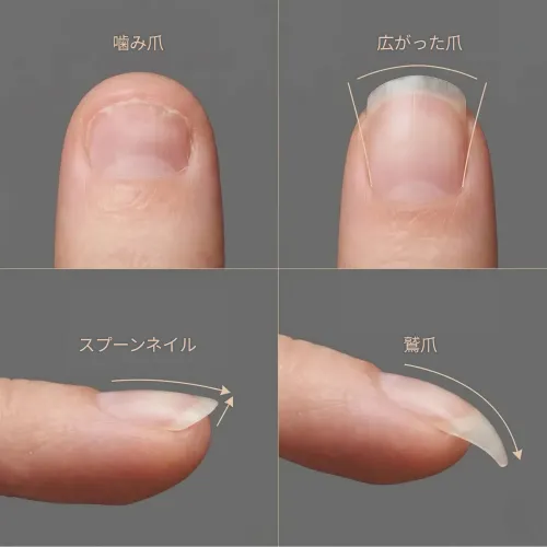 <p>さまざまな爪タイプに対応する爪のタイプ別診断術</p>